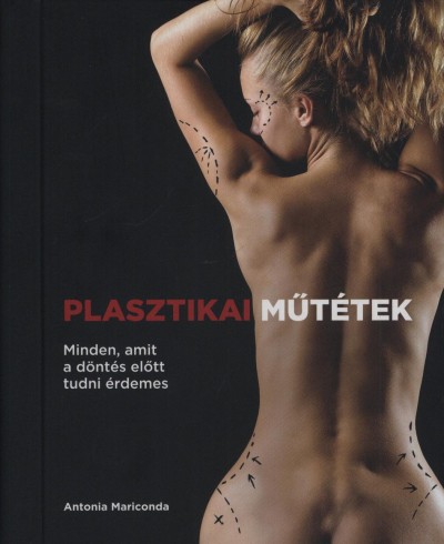 Antonia Mariconda - Plasztikai m�t�tek