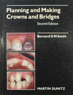 Bernard G. N. Smith - Planning and making crowns and bridges