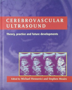 Michael G. Hennerici   (Szerk.) - Stephen P. Meairs   (Szerk.) - Cerebrovascular ultrasound
