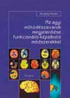 Dr. Borbly Katalin - Az agyi mkdszavarok megjelentse funkcionlis kpalkot mdszerekkel