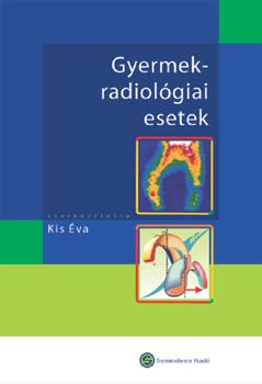Gyermekradiol�giai esetek