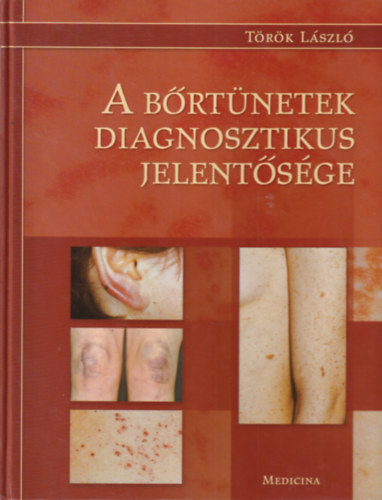 T�r�k L�szl� - A b�rt�netek diagnosztikus jelent�s�ge
