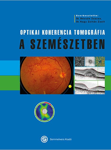 Récsán Zsuzsanna Nagy Zoltán Zsolt dr. - Optikai koherencia tomográfia a szemészetben