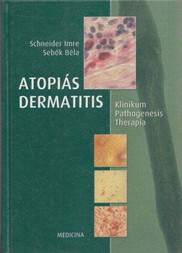 Dr. Schneidern; Dr. Seb�k - Atopi�s dermatitis