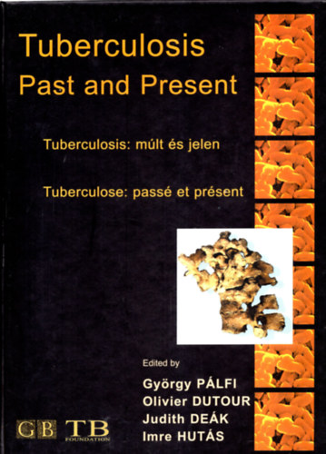 Olivier-Dek Judit-Huts Imre Plfi Gyrgy-Dutouor - Tuberculosis: mlt s jelen - Past and Present - Pass et present (tbbnyelv)