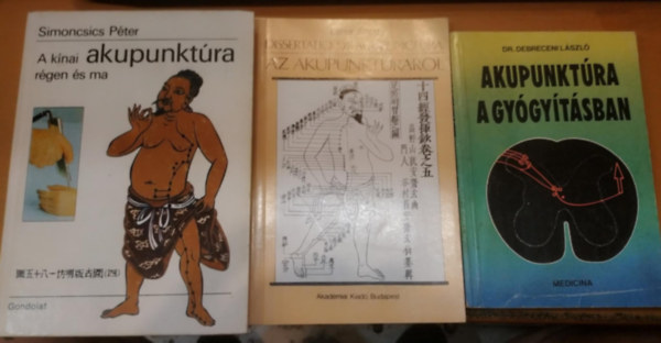 Dr. Debreceni Lszl, Laner Antal, Dr. Simoncsics Pter - 3 db Akupunktra a gygytsban + Dissertatio de acupunctura az akupunktrrl + A knai akupunktra rgen s ma