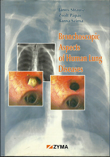 Strausz - P�pai - Szima - Bronchoscopic Aspects of the Human Lung Diseases