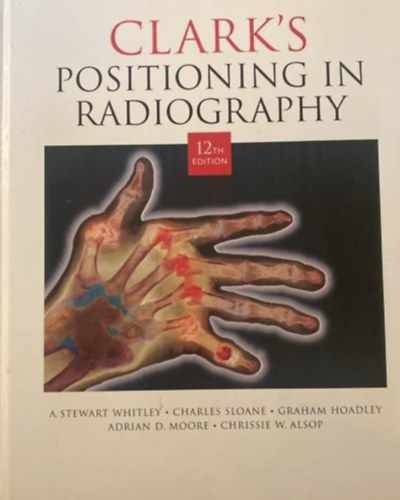 Positioning in radiography