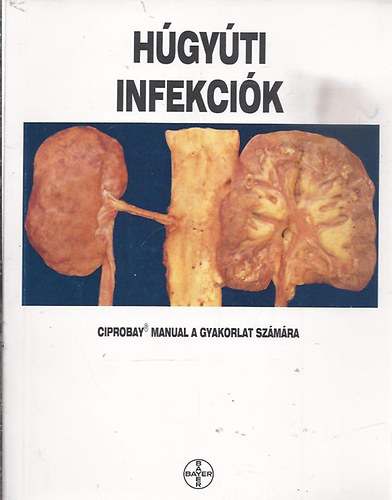 H�gy�ti infekci�k