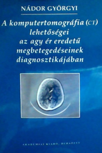 Ndor Gyrgyi - A komputertomogrfia (CT) lehetsgei az agy r eredet megbetegedseinek diagnosztikjban