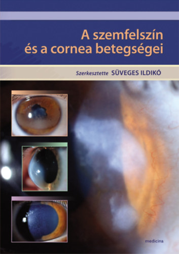 Süveges Ildikó - A szemfelszín és a cornea betegségei