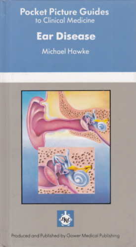 Michael Hawke - Ear Disease - Pocket Picture Guides to Clinical Medicine (Flbetegsgek - angol nyelv)