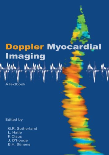L. Hatle, F.E. Rademakers, P. Claus, J.D'hooge, B.H. Bijnens G.R.Sutherland - Doppler myocardial imaging - Textbook