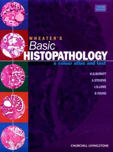 A. Stevens, J.S. Lowe, B.Young H.G. Burkitt - Wheater's Basic Histopathology: A Colour Atlas and Text (Third Edition)