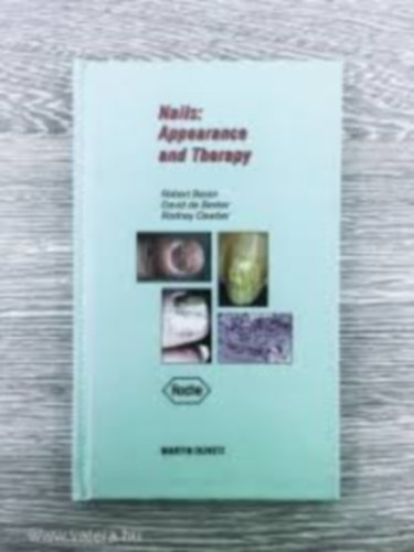 David de Berker, Rodney Dawber Robert Baran - Nails: Appearance And Therapy