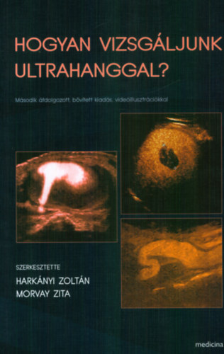 Harknyi Zoltn  (szerk.); Morvay Zita (szerk.) - Hogyan vizsgljunk ultrahanggal?