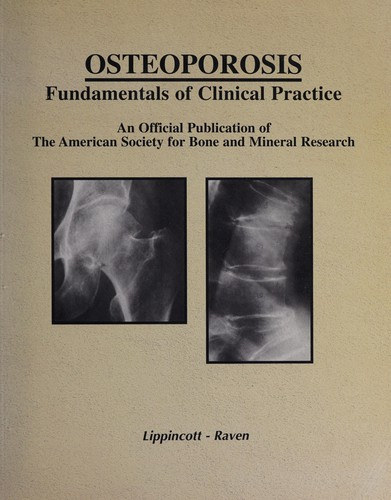 Murray J. Favus  (szerk.) - Osteoporosis - Fundamentals of Clinical Practice