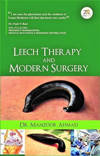 Dr. Manzoor Ahmad - Leech Therapy and Modern Surgery