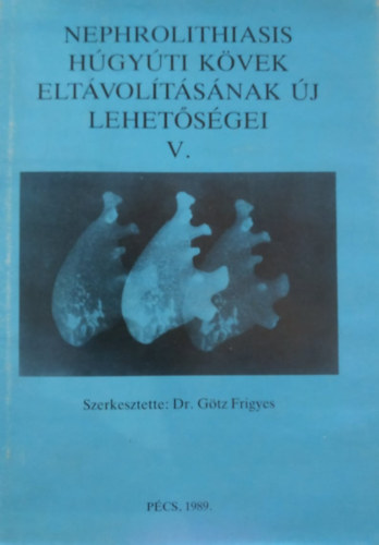 Dr. Götz Frigyes - Nephrolithiasis Húgyúti kövek eltávolításának új lehetőségei V.