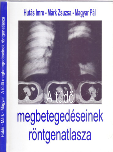 Huts Imre - Mrk Zsuzsa - Fszerkeszt: Forgcs Sndor dr. Magyar Pl - A td megbetegedseinek rntgenatlasza (Novartis)