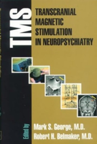 Mark S. George - Transcranial Magnetic Stimulation in Neuropsychiatry