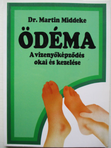 Martin Midekke - Ödéma - A vizenyőképződés okai és kezelése