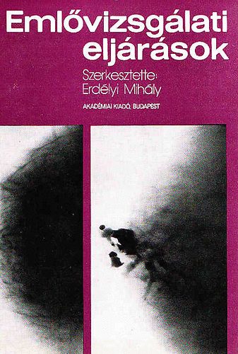 Erdélyi Mihály (szerk.) - Emlővizsgálati eljárások