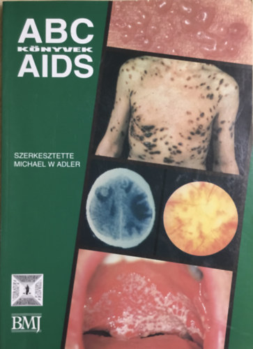Michael  W Adler - ABC Knyvek AIDS