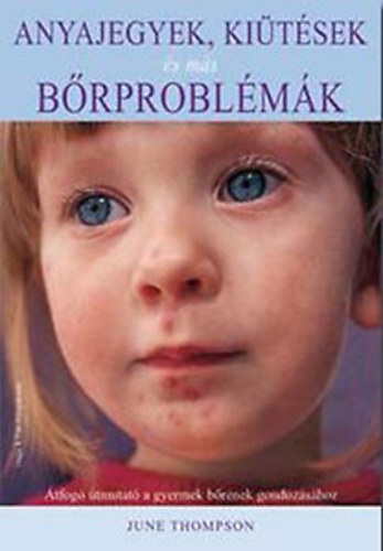June Thompson - Anyajegyek, kitsek s ms brproblmk - tfog tmutat a gyermek brnek gondozshoz