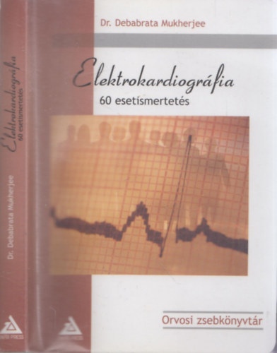 Dr. Debabrata Mukherjee - Elektrokardiogrfia - 60 esetismertets (Orvosi Zsebknyvtr)