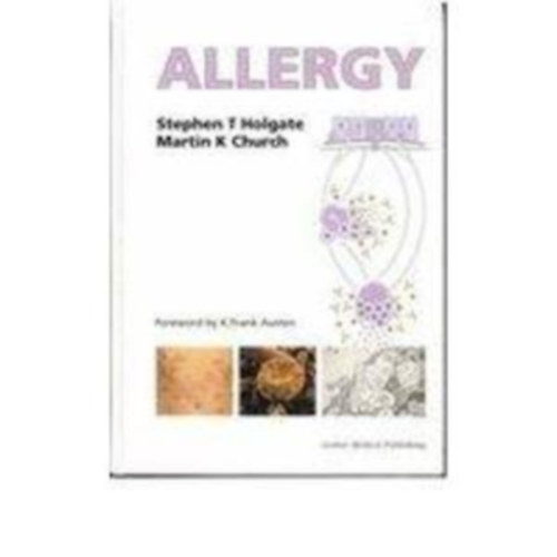 Stephen T. Holgate - Martin K. Church - Allergy (Allergia - angol nyelv)