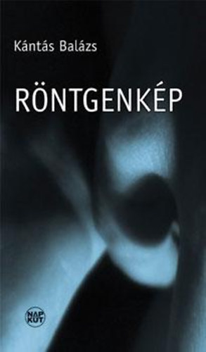 K�nt�s Bal�zs - R�ntgenk�p