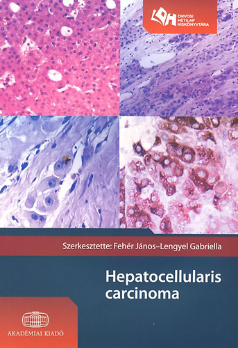 Feh�r J�nos; Lengyel Gabriella - Hepatocellularis carcinoma