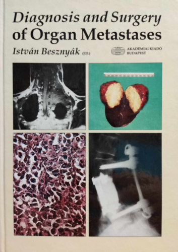 Beszny�k Istv�n - Diagnosis and Surgery of Organ Metastases