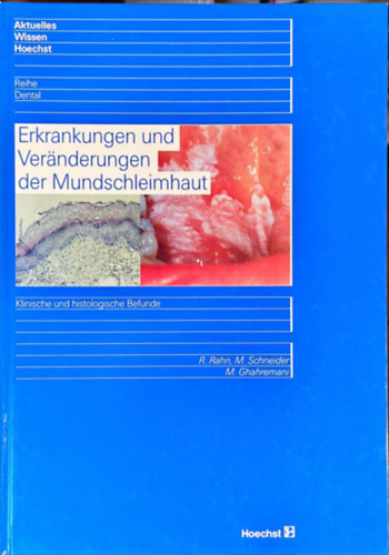 M. Schneider, M. Ghahremani R. Rahn - Erkrankungen und Veränderungen der Mundschleimhaut
