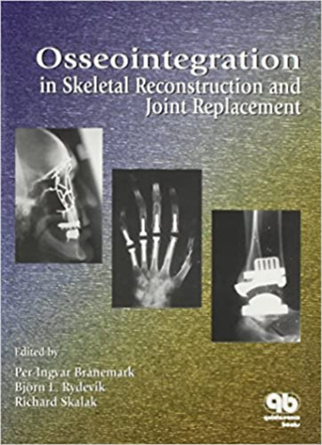 Bj�rn L. Rydevik - Osseointegration  in Skeletel Reconstruction and Joint Replacement