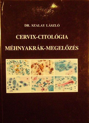 Dr. Szalay Lszl - Cervix-citolgia - Mhnyakrk-megelzs