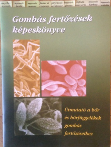 Gombs fertzsek kpesknyve