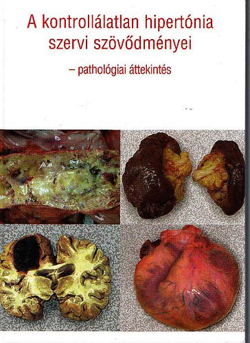 Dr. Sípos Gábor; Dr. Habony Norbet - A kontrollálatlan hipertónia szervi szövődményei - Pathológiai áttekintés