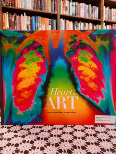 Thomas F. L�scher - Hart in art. From a normal heart to heart failure. /Az eg�szs�ges sz�vt�l a sz�vel�gtelens�gig/