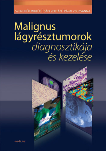 S�pi Zolt�n, P�pai Zsuzsa  Szendr�i Mikl�s (szerkeszt�k) - Malignus l�gyr�sztumorok diagnosztik�ja �s kezel�se