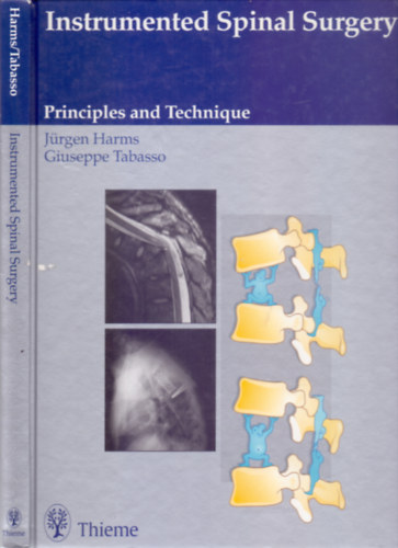 Jrgen Harms M.D. - With the collaboration of Rocco Cinanni M.D. Giuseppe Tabasso M.D. - Instrumented Spinal Surgery - Principles and Technique (503 illustrations)
