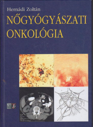 Hern�di Zolt�n - N�gy�gy�szati onkol�gia