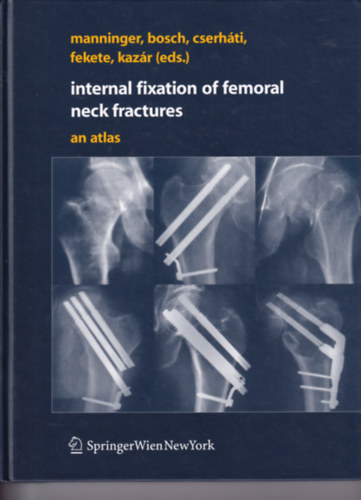 P�ter Cserh�ti, K�roly Fekete, Gy�rgy Kaz�r Jen� Manninger - Internal Fixation of Femoral Neck Fractures